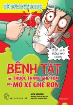 Horrible Science – Bệnh Tật – Từ Thuốc Thang Ghê Tởm Đến Mổ Xẻ Ghê Rợn